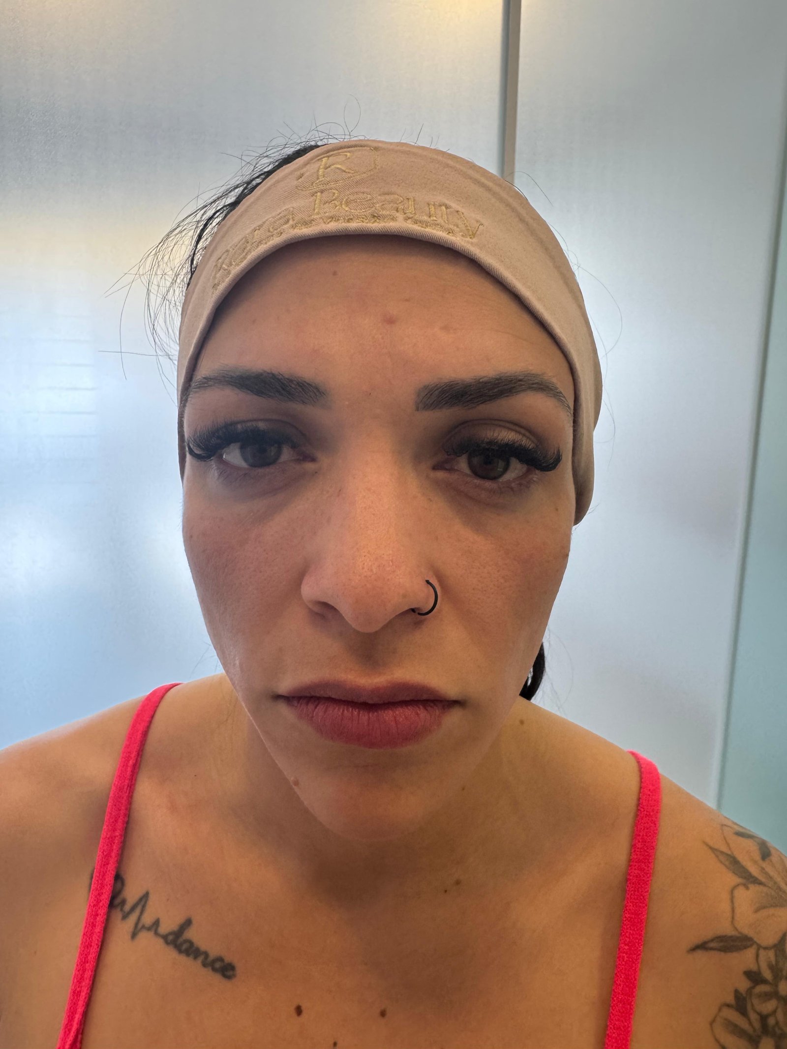 Antes do Preenchimento